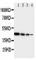 Anti-TRIF Antibody
